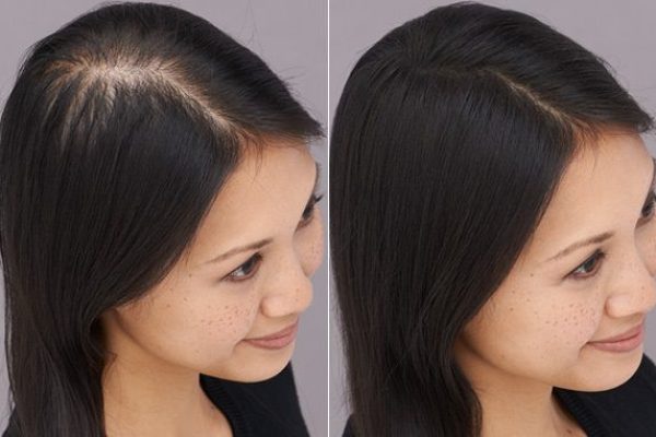 25b9515790a53bbe833a3b1c93f6cd0d