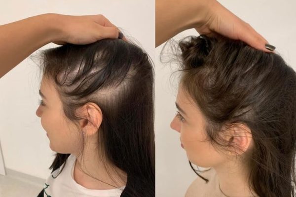 44d3a9bdb5b9d7cc176d271466281ee4