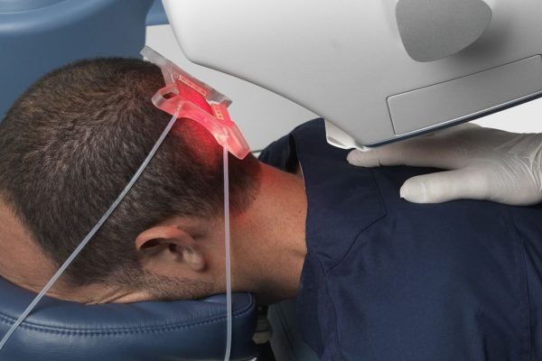 Robotic-hair-transplantation