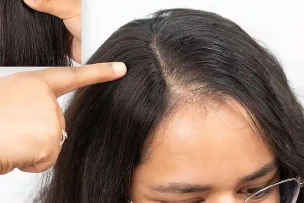 Untitled-1-3-1024x585