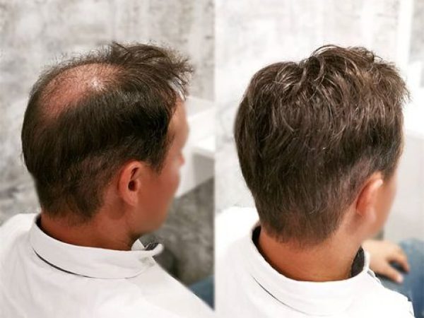 a860ec70ed155f8adf6e5d87c7b86b10