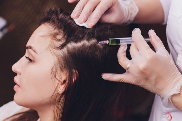 Your Scalp's 72-Hour Journey After Exosome Treatment