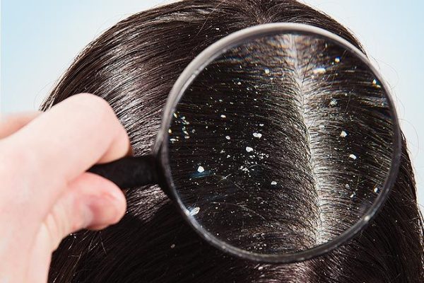 f46e7b5200c88f4870a1c06c14a96c9c